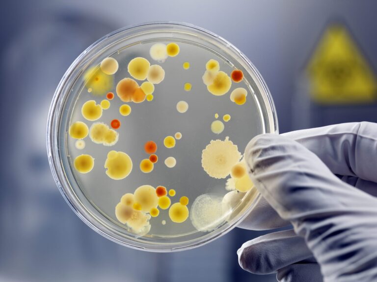 Specimens in a petri dish held by a hand